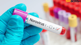 Norovirüs belirtileri