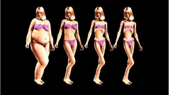 Anoreksiya Ne Demek, Nedenleri Nelerdir?